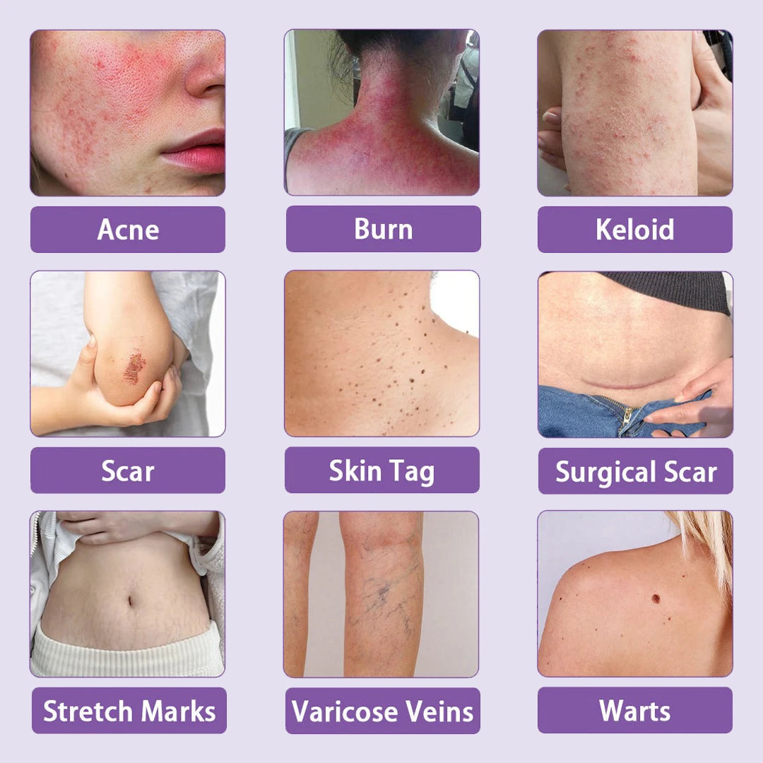 DermaFuse® Nano-Microneedle Repair Patch [Clear Skin in 2–3 Weeks]