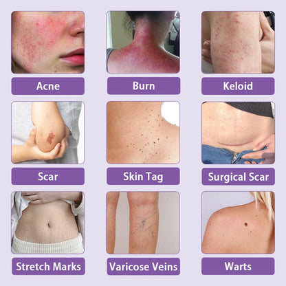 DermaFuse® Nano-Microneedle Repair Patch [Clear Skin in 2–3 Weeks]