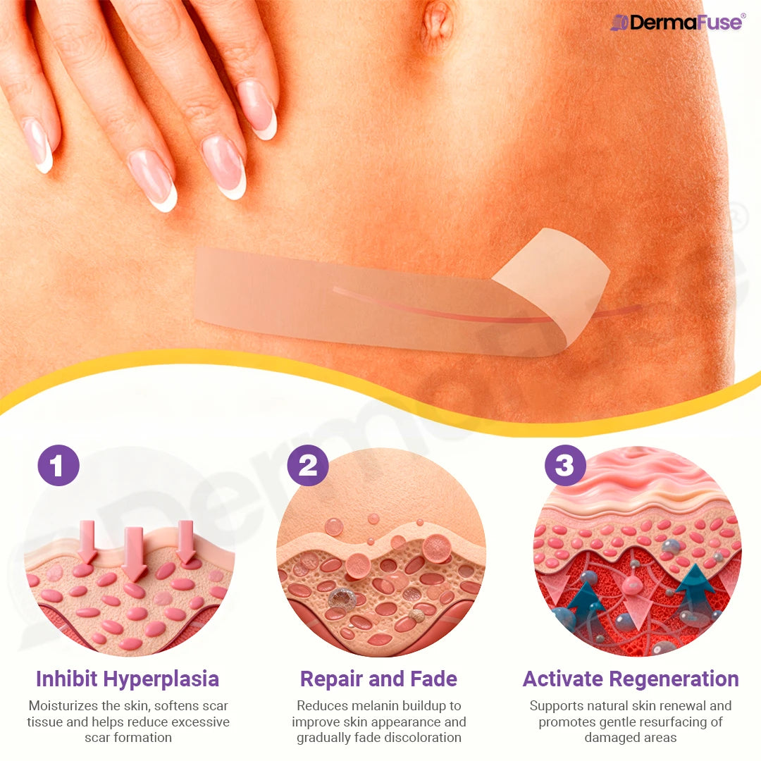 DermaFuse® Nano-Microneedle Repair Patch [Clear Skin in 2–3 Weeks]