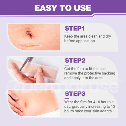 DermaFuse® Nano-Microneedle Repair Patch [Clear Skin in 2–3 Weeks]